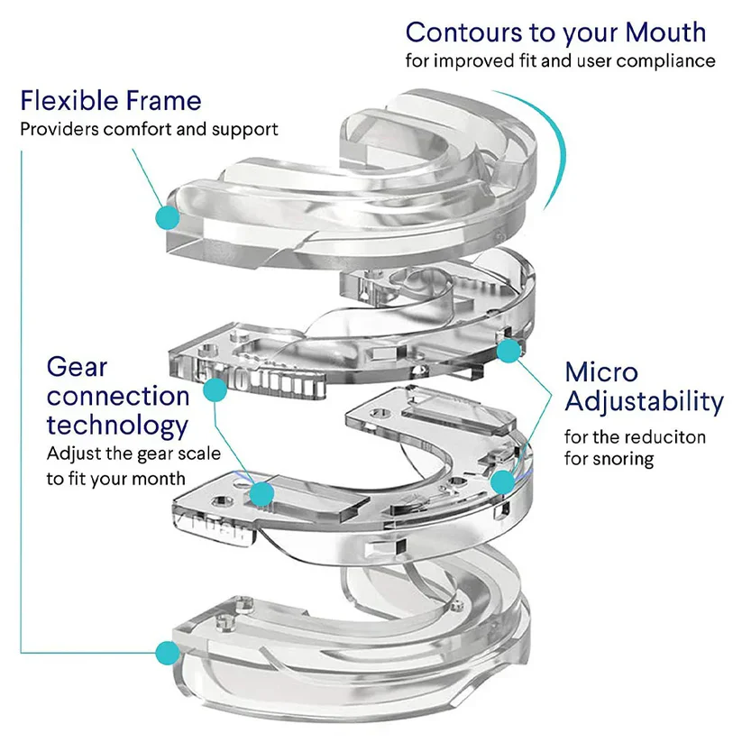 Griqos™ Anti Snoring Mouthpiece - Say goodbye to sleepless nights - Image 4